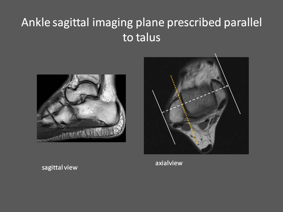 Mri Ankle How We Do It How Is Mri Ankle Done At Mater Dei Hospital